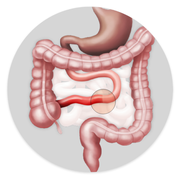 Anatomia jejunoileal