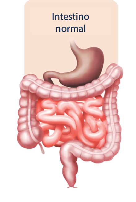 Intestino normal